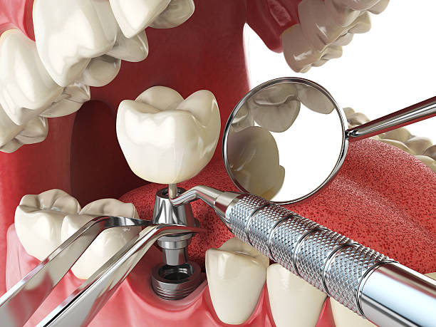 Best Emergency Dental Care for Broken or Chipped Teeth in Hewlett Harbor, NY
